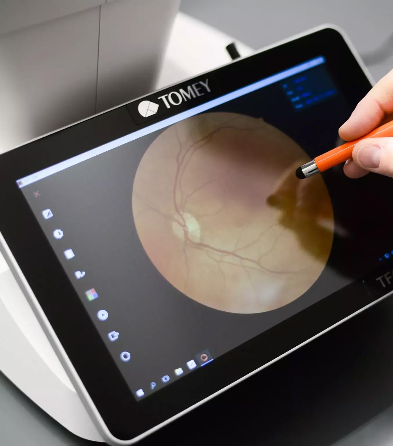 NetzhautanalyseTablet Sehanalyse für Augeninnendruckmessung